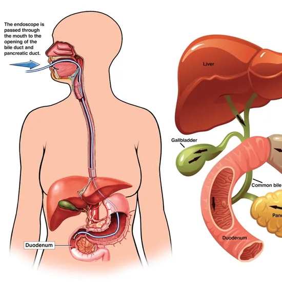 gallbladder biopsy